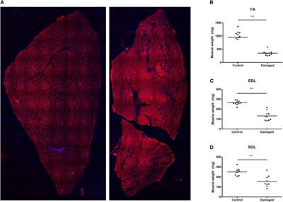 Muscle Atrophy Due to Nerve Damage Is Accompanied by Elevated Myofibrillar Protein Synthesis Rates